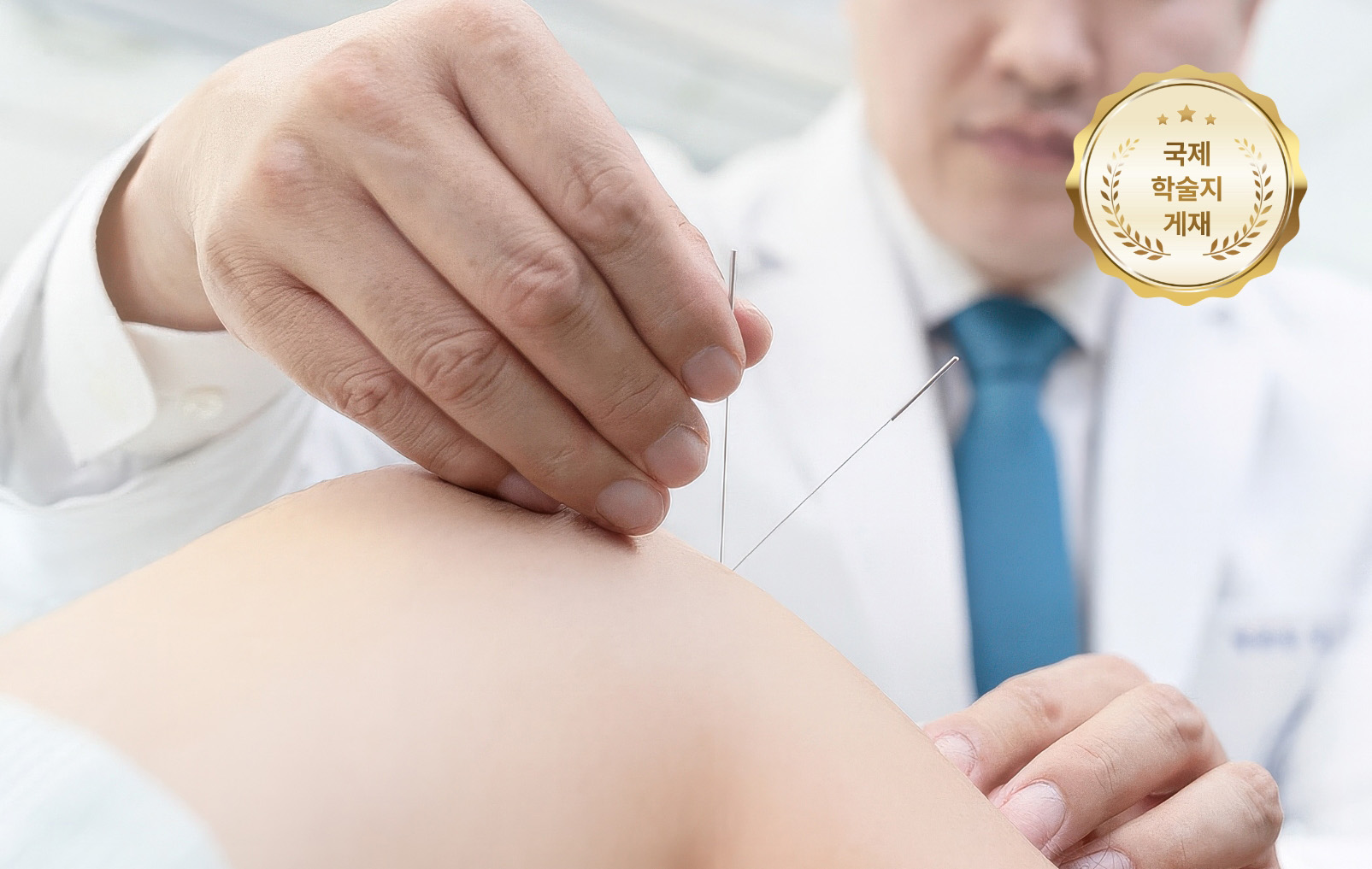 환자의 무릎에 침 시술 하고 있는 의사